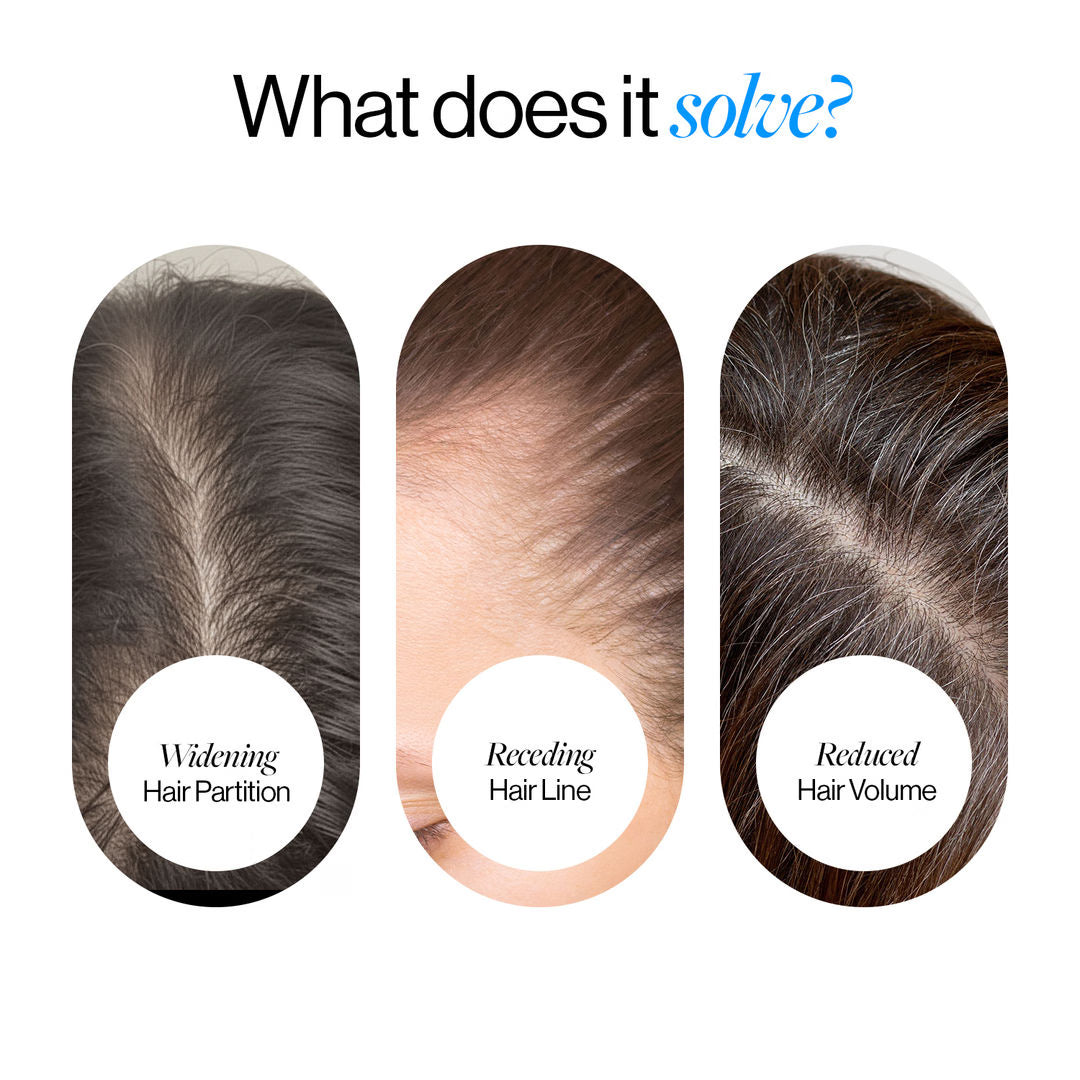 Advanced Hair Density Roll-On Serum 25 ml