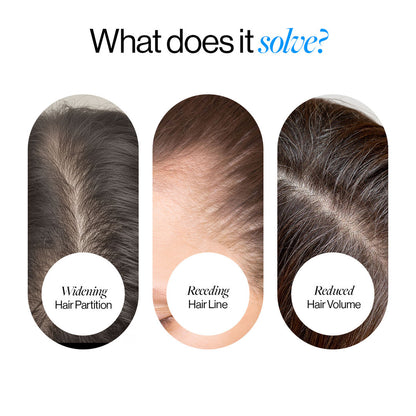 Advanced Hair Density Roll-On Serum 25 ml