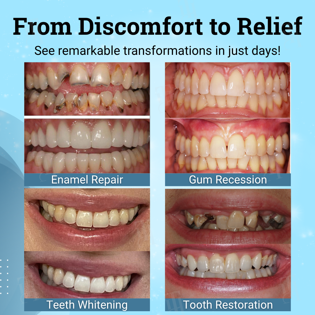 Mia nonna lo consiglia a tutti🛡️ Salva i tuoi denti senza intervento chirurgico! Gel di sutura gengivale non chirurgico AEXZR®