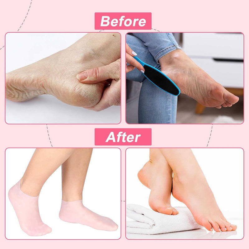 💥Køb 2 få 1 gratis-Exfolierende silikone strandsokker - Foryng dine fødder! 👣💕