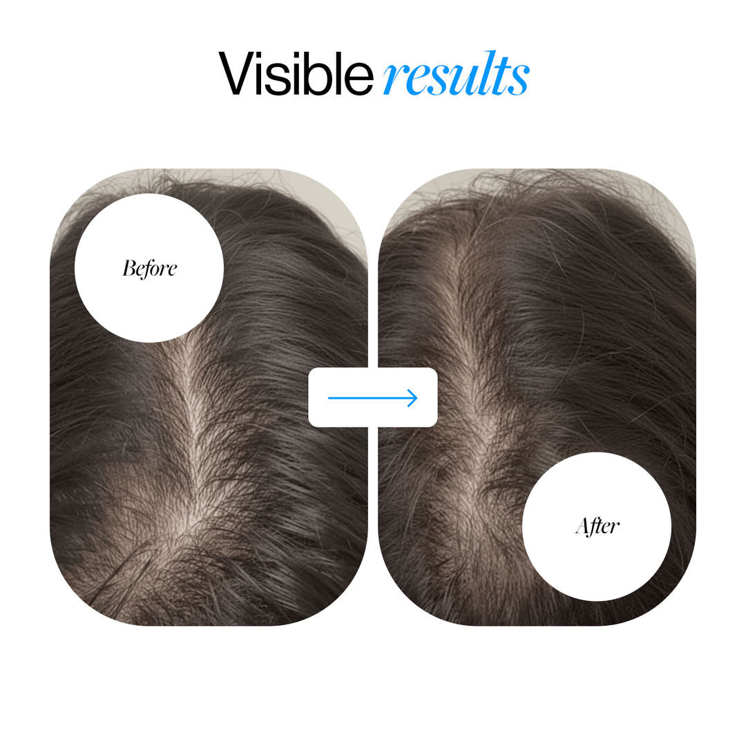 Advanced Hair Density Roll-On Serum 25 ml