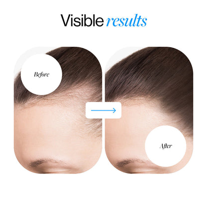 Advanced Hair Density Roll-On Serum 25 ml