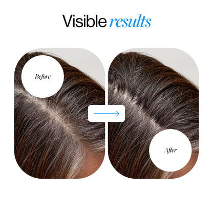 Advanced Hair Density Roll-On Serum 25 ml