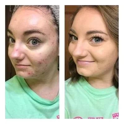🎉3-i-1 Concealer Palette（🎉3-i-1 Concealer Palette）