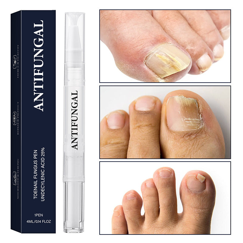 ✨ Nuovi Arrivi 🔥 Penna per il trattamento della micosi delle unghie dei piedi per unghie danneggiate